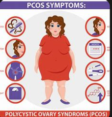 PCOS symptoms